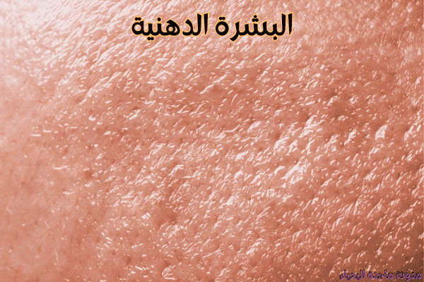 روتين العناية بالبشرة في الشتاء - البشرة الدهنية